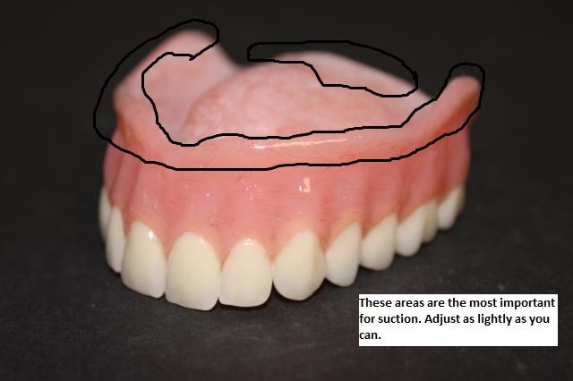 denture adjustments upper dentures too mouth adjusting much following