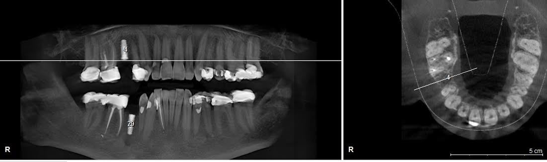 Dental X Ray Chart