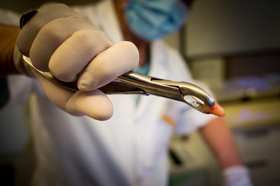 The Tooth Extraction Survival Guide The Healthy Mouth Project