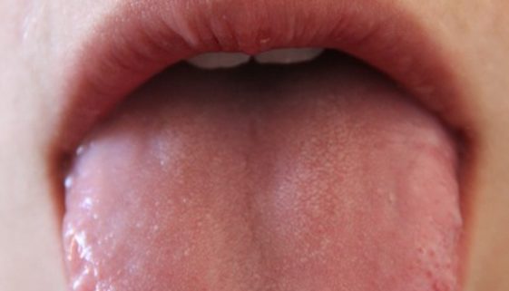 tongue-181725_960_720